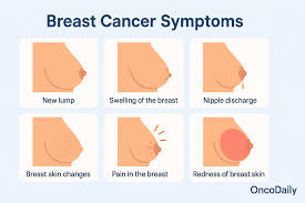 Understanding Breast Cancer