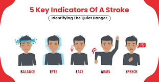 How To Spot A Stroke